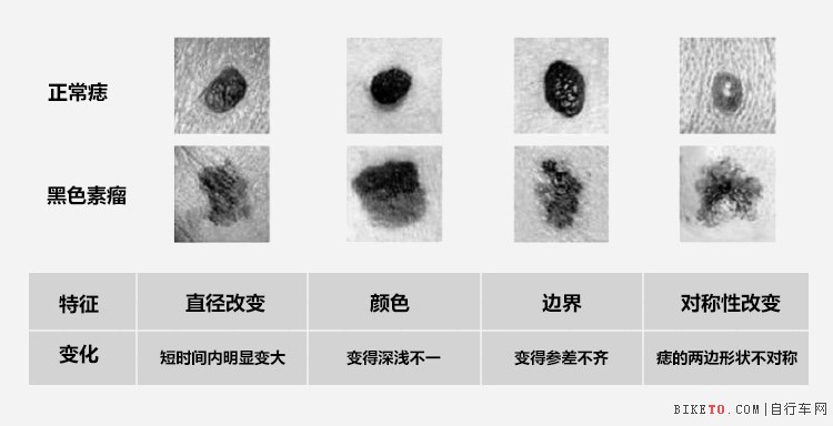 黑色素瘤肿瘤标志物图片